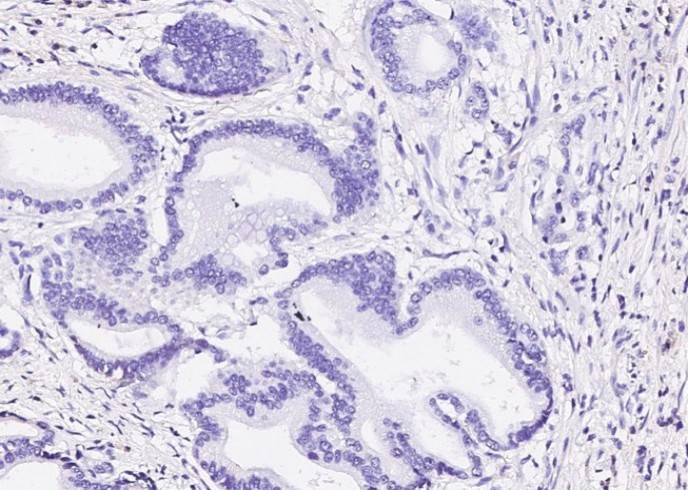Recombinant KRT5 Monoclonal Antibody - small - 2