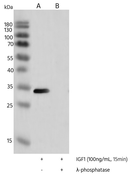 Recombinant Phospho-S6 Ribosomal Protein (Ser235, 236) Monoclonal Antibody - small - 3