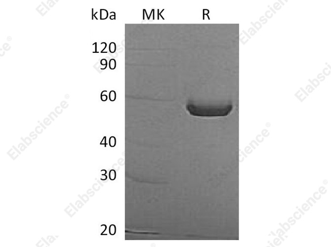 Recombinant Human ALDH1A3 Protein (His Tag) - 1