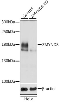 Western blot analysis of extracts from normal (control) and ZMYND8 knockout (KO) HeLa cells, using ZMYND8 Polyclonal Antibody at 1:3000 dilution.