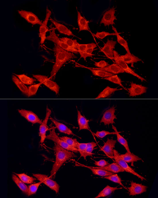 Immunofluorescence analysis of PC-12 cells using Cleaved Caspase-9 P37 Polyclonal Antibody at dilution of 1:50 (40x lens). Blue:DAPI for nuclear staining.