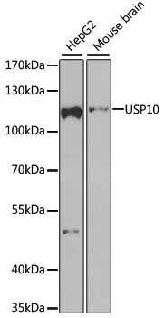 Western blot analysis of extracts of various cell lines using USP10 Polyclonal Antibody at 1:1000 dilution.