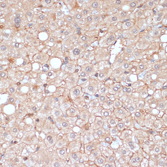 Immunohistochemistry of paraffin-embedded Human liver using MMP9 Polyclonal Antibody at dilution of 1:100 (40x lens).