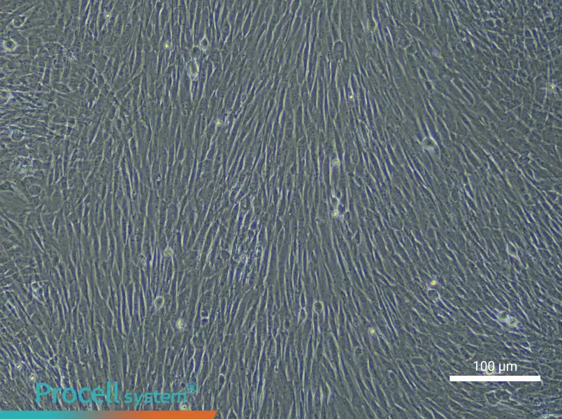 Human Dermal Fibroblast (Primary cell immortalization) Complete MediumHuman Dermal Fibroblast (Primary cell immortalization) Complete Medium - 3