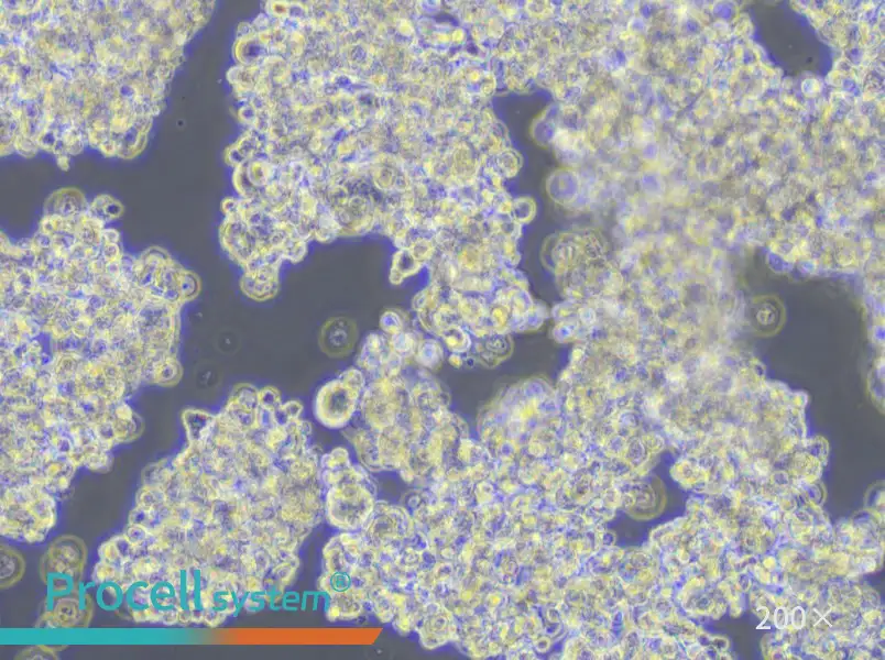 NCI-H187 Cell Complete Medium - 6