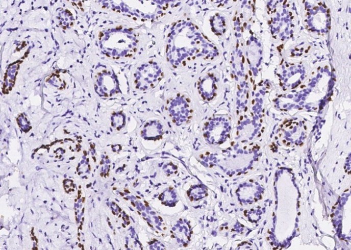 Recombinant p63(alpha) Monoclonal Antibody - small - 3