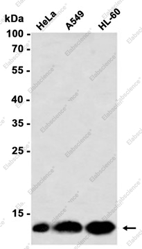 Recombinant Dynein Light Chain Tctex Type 1 Monoclonal Antibody - 3