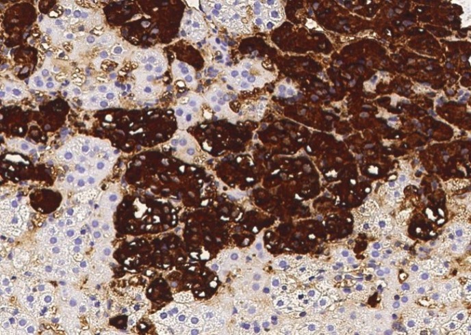 Recombinant Chromogranin A/CHGA/CGA Monoclonal Antibody - small - 2