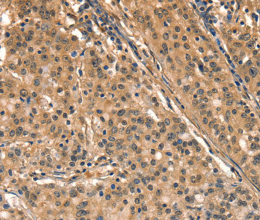 AIMP1 Polyclonal Antibody - 2