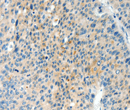 TPM2 Polyclonal Antibody - 2