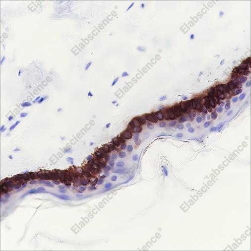 Recombinant Keratin 15 Monoclonal Antibody - 5