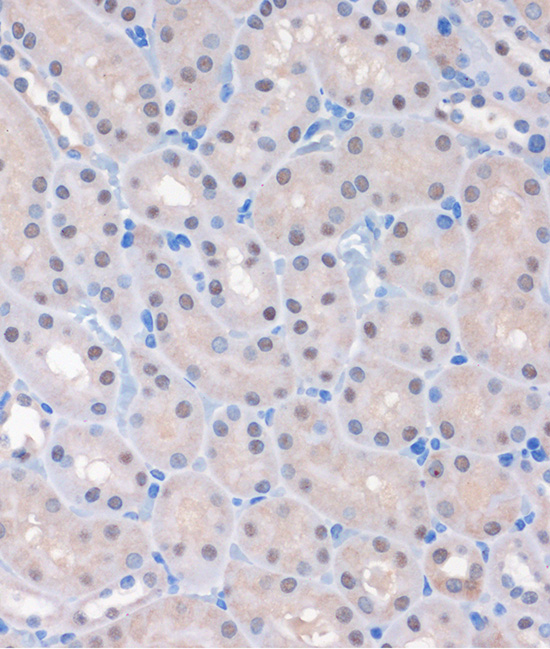 Immunohistochemistry of paraffin-embedded Mouse kidney using MTMR8 Polyclonal Antibody at dilution of 1:100 (40x lens).Perform microwave antigen retrieval with 10 mM PBS buffer pH 7.2 before commencing with IHC staining protocol.