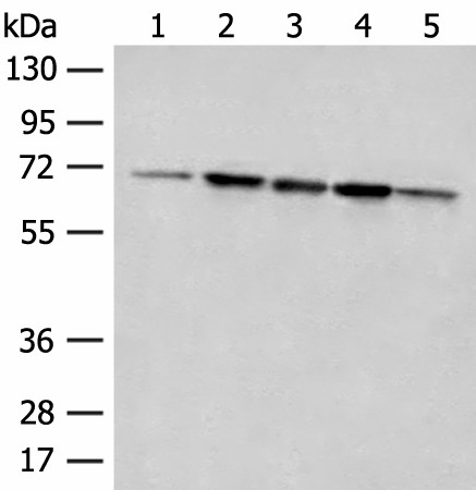 Western blot analysis of 293T cell Rat liver tissue A172 and Jurkat cell lysates  using ACSF2 Polyclonal Antibody at dilution of 1:400