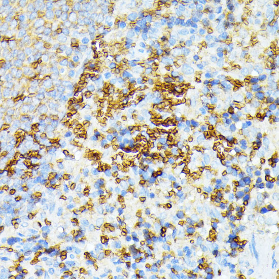 Immunohistochemistry of paraffin-embedded Rat spleen using SPTA1 Polyclonal Antibody at dilution of  1:100 (40x lens).