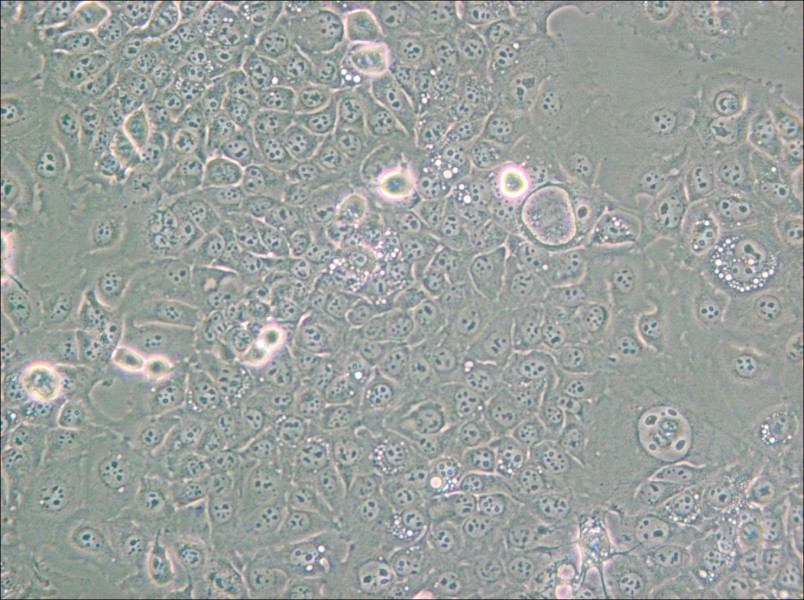 KYSE-30 Cell Complete Medium - small - 6