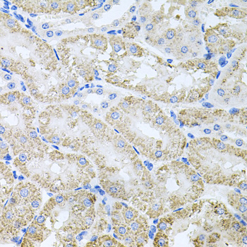 Immunohistochemistry of paraffin-embedded Mouse kidney using TARS Polyclonal Antibody at dilution of 1:100 (40x lens).