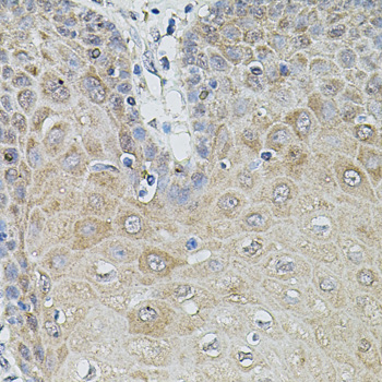 Immunohistochemistry of paraffin-embedded Human esophagus using MMP9 Polyclonal Antibody at dilution of 1:100 (40x lens).