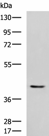 Western blot analysis of Mouse heart tissue lysate  using STK32A Polyclonal Antibody at dilution of 1:1000