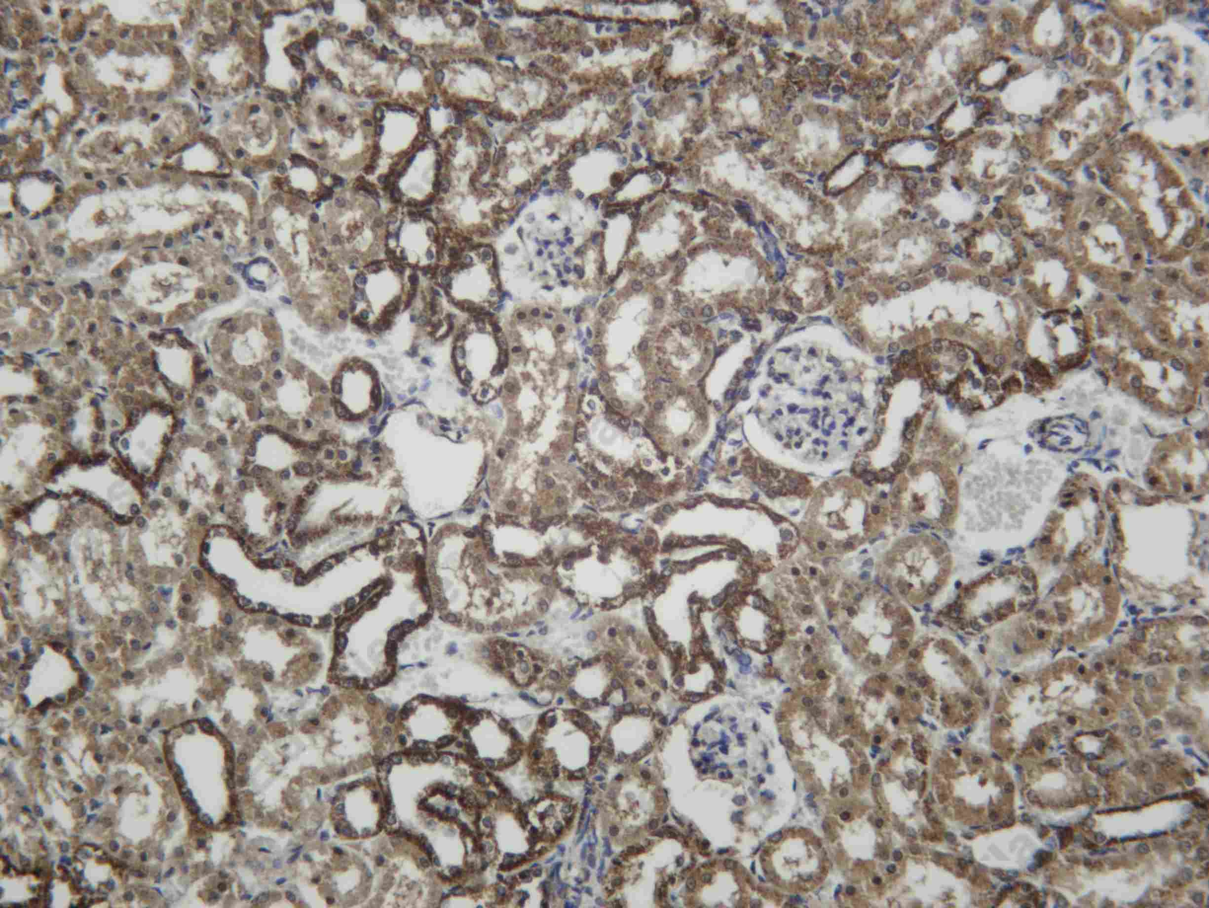 Recombinant SGK1 Monoclonal Antibody - 3