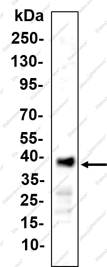 Recombinant SCD Monoclonal Antibody - 1