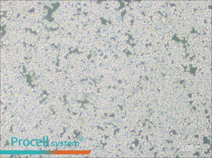 RPMI 8226 Cell Complete Medium - 1