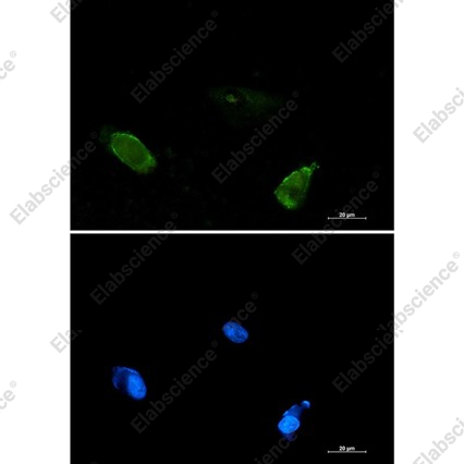 Recombinant BIN1 Monoclonal Antibody - 3
