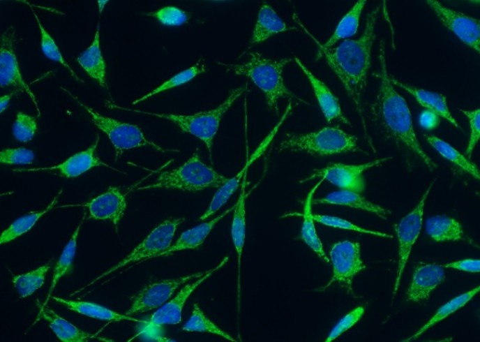C1QBP/HABP1 Monoclonal Antibody - small - 2