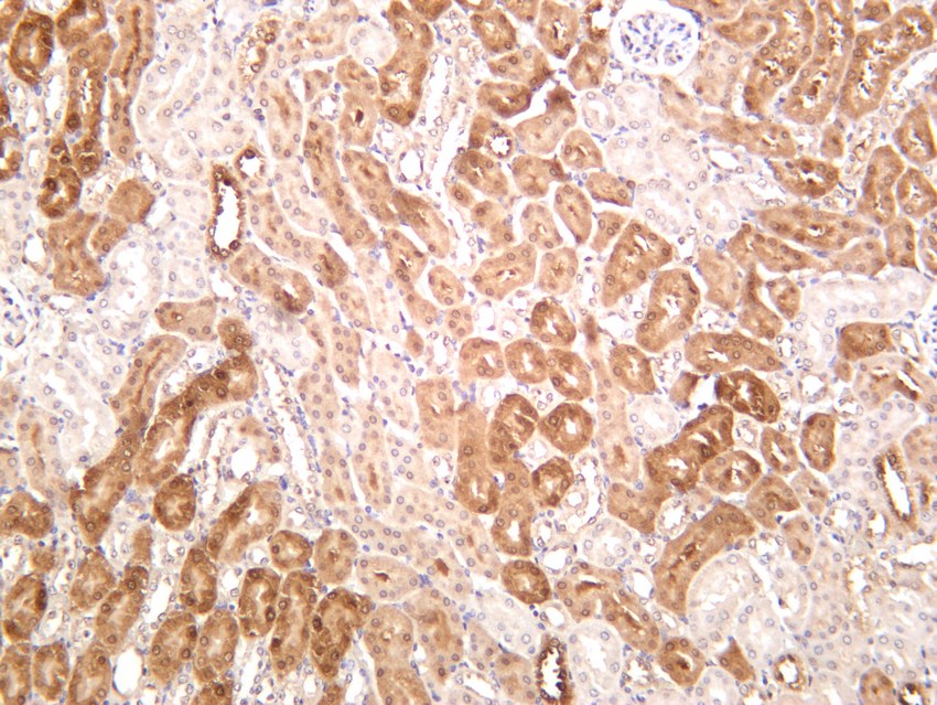 Recombinant NQO1 Monoclonal Antibody - small - 6