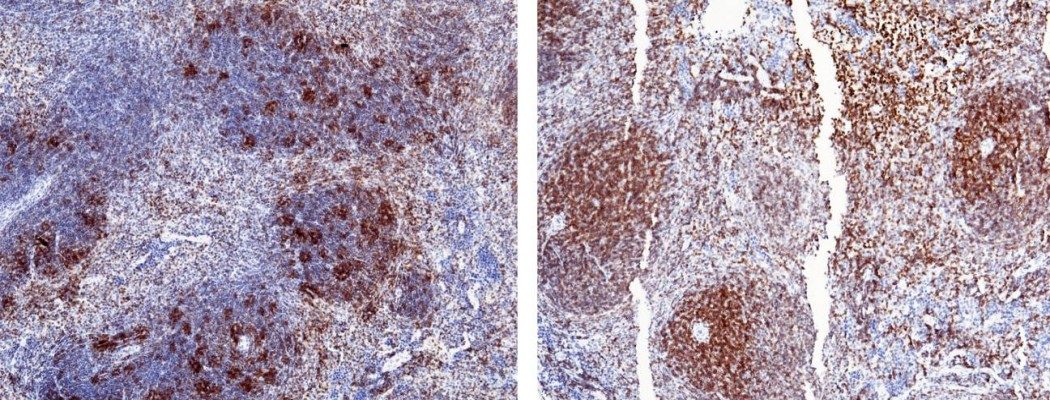 Recombinant CD2 Monoclonal Antibody-searchlist-1