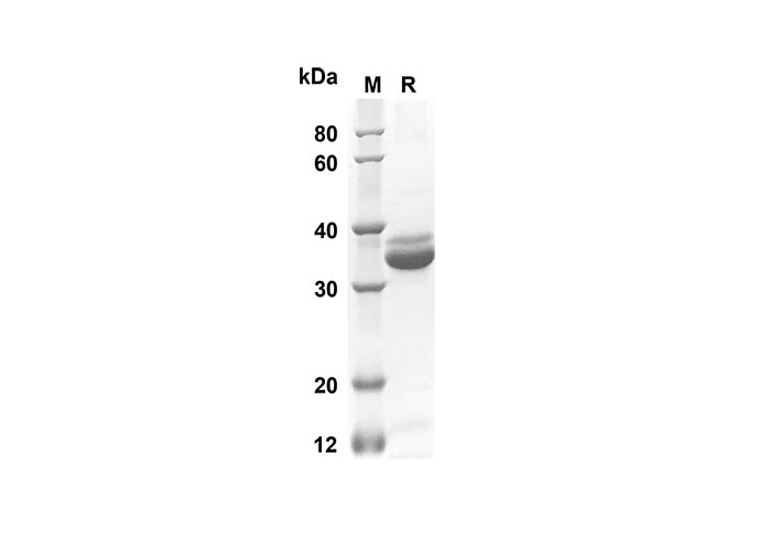 Recombinant Rat IL-10 Protein(Trx Tag)-1