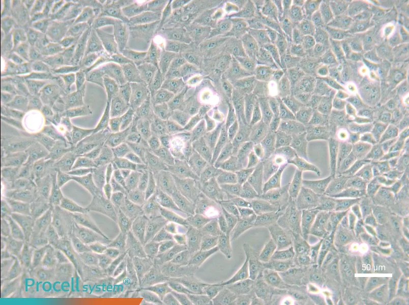 9L/lacZ Cell Complete Medium - small - 5