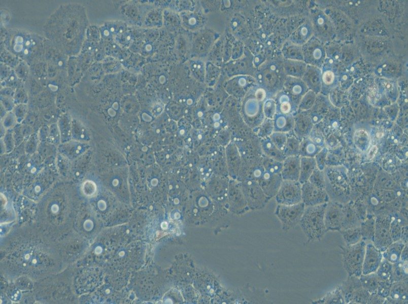 HARA-B Cell Complete Medium - 6