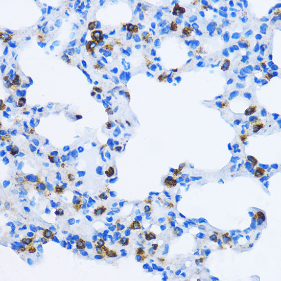 Immunohistochemistry of paraffin-embedded Rat lung using EEA1 Polyclonal Antibody at dilution of  1:100 (40x lens).