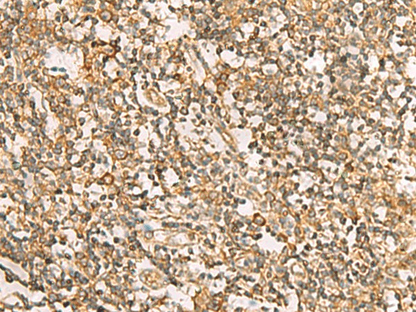 Immunohistochemistry of paraffin-embedded Human tonsil tissue  using DNAJA4 Polyclonal Antibody at dilution of 1:55(?200)