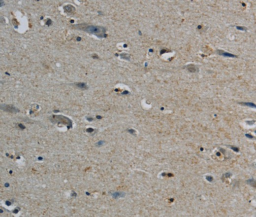 Immunohistochemistry of paraffin-embedded Human brain tissue using PERK Polyclonal Antibody at dilution 1:50