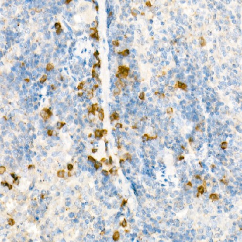 Immunohistochemistry of paraffin-embedded mouse spleen using IL27RA Polyclonal Antibody at dilution of 1:25 (40x lens).Perform high pressure antigen retrieval with 10 mM citrate buffer pH 6.0 before commencing with IHC staining protocol.