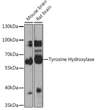 Western blot analysis of extracts of various cell lines using Tyrosine Hydroxylase Polyclonal Antibody at 1:1000 dilution.