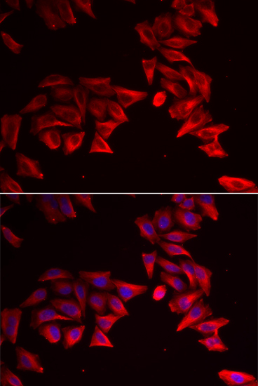 Immunofluorescence analysis of HeLa cells using SFRP4 Polyclonal Antibody Blue: DAPI for nuclear staining.