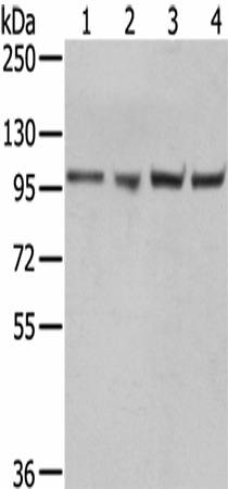 Western Blot analysis of A431, 293T, Hela and K562 cells using TPX2 Polyclonal Antibody at dilution of 1/800