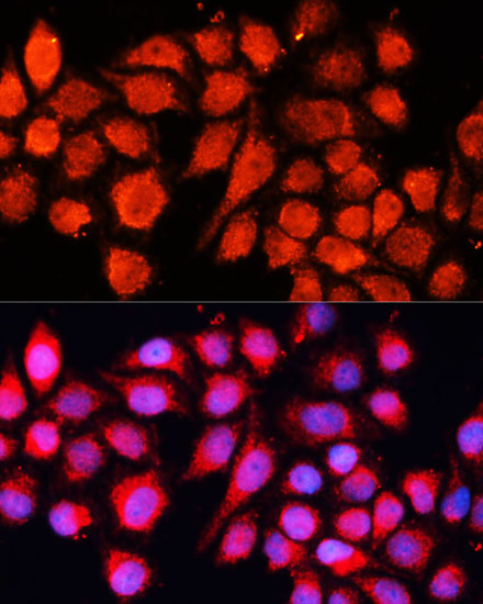 Immunofluorescence analysis of HeLa cells using MRPS28 Polyclonal Antibody at dilution of  1:100 (40x lens). Blue: DAPI for nuclear staining.