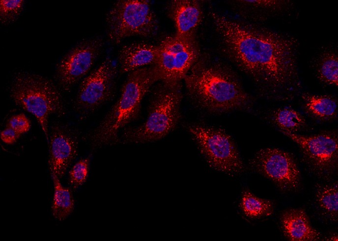 Recombinant Cathepsin D/CTSD Monoclonal Antibody-searchlist-1