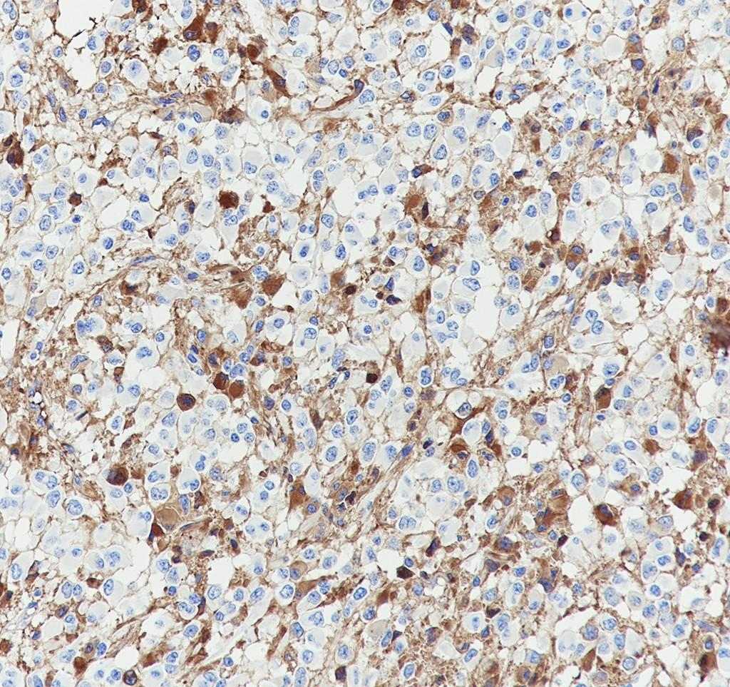 Recombinant EAAT3 Monoclonal Antibody - small - 3