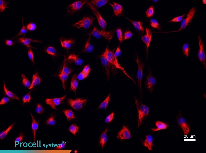 Mouse Renal Fibroblast Complete Medium - 2