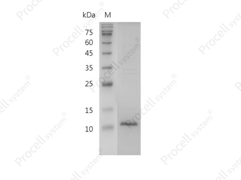 &beta;-NGF/NGF/NGFB/NGF-&beta;, Human, Recombinant