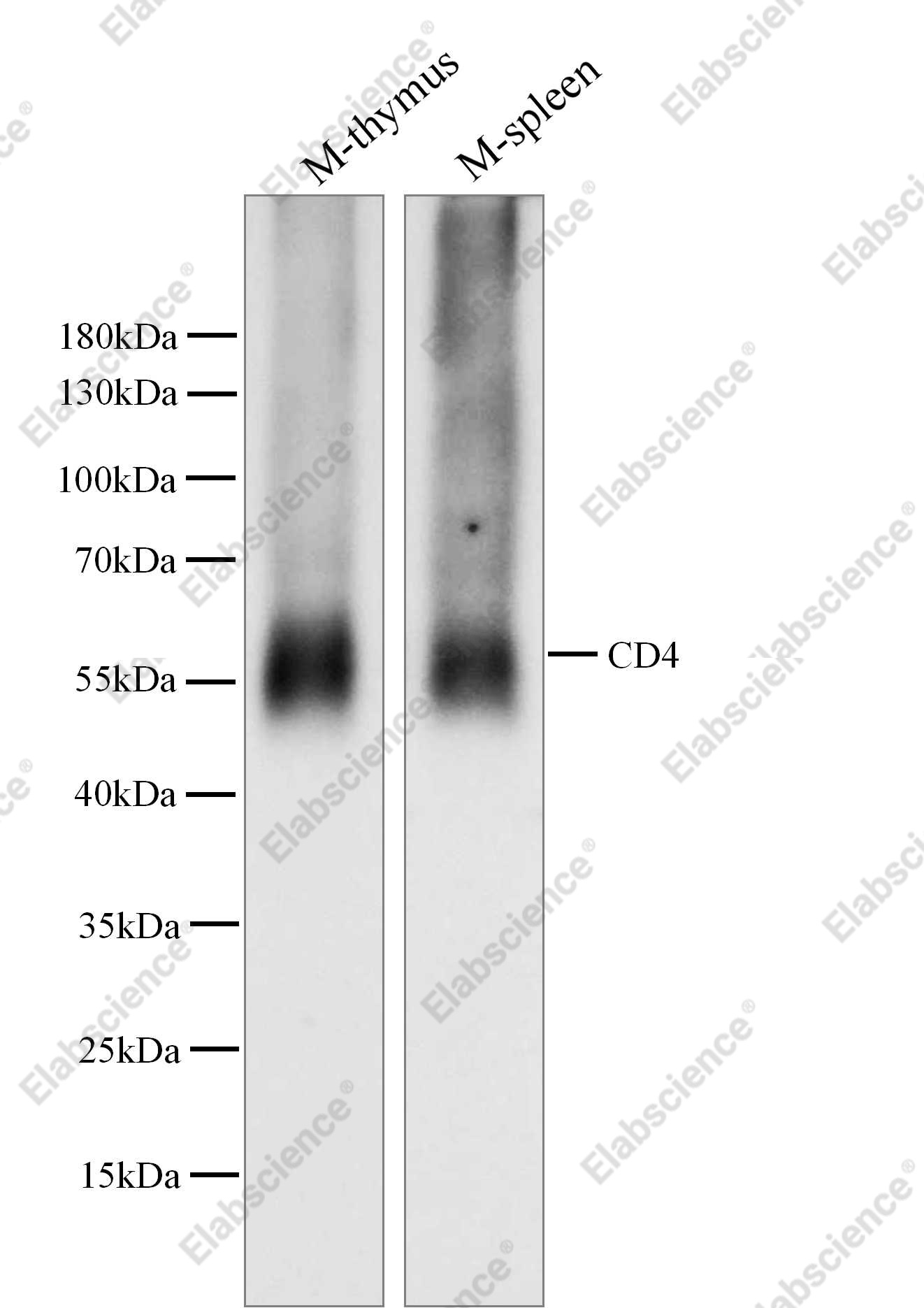 Recombinant CD4 Monoclonal Antibody - 1