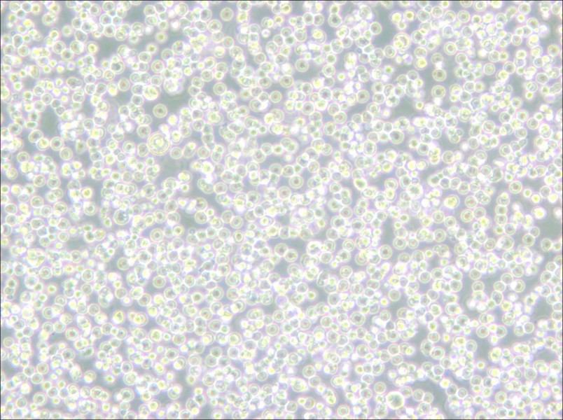 BALL-1 Cell Complete Medium - 4