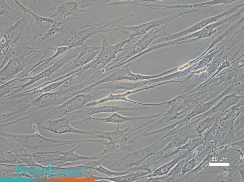 Human Corneal Stromal Cell Complete Medium - 4