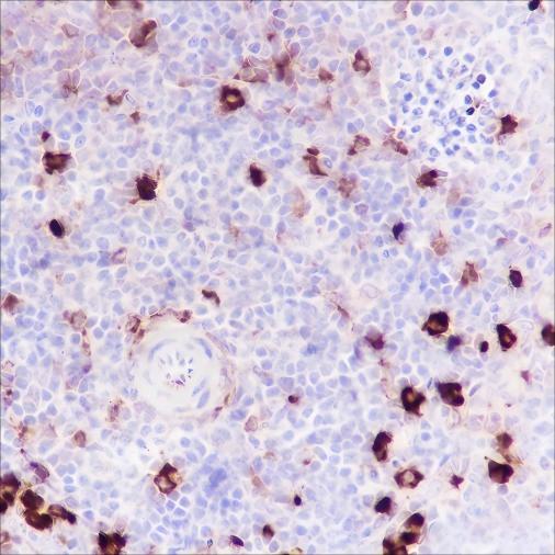Recombinant Phospho-S6 Ribosomal Protein (Ser240, 244) Monoclonal Antibody - small - 6