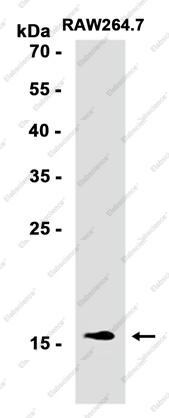 Recombinant SFT Monoclonal Antibody - 2