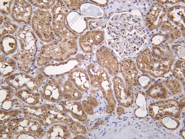 Recombinant PPP2R2A Monoclonal Antibody - 1